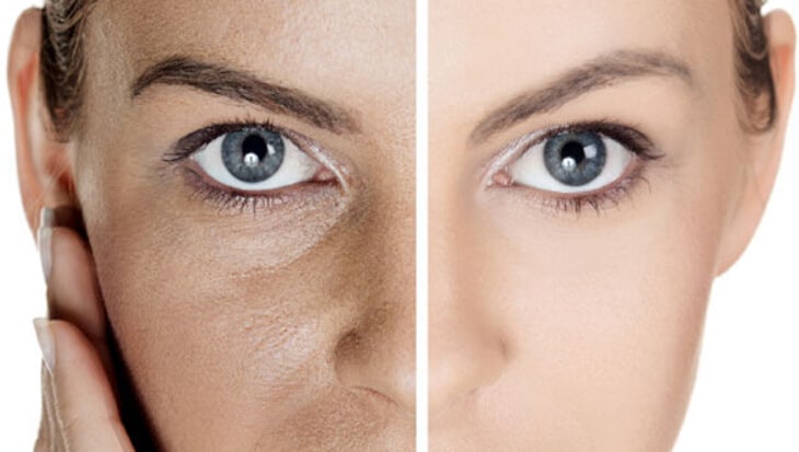 تنظيف المسام المسدودة