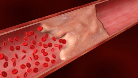أفضل 10 أطعمة لتنظيف الأوردة والشرايين