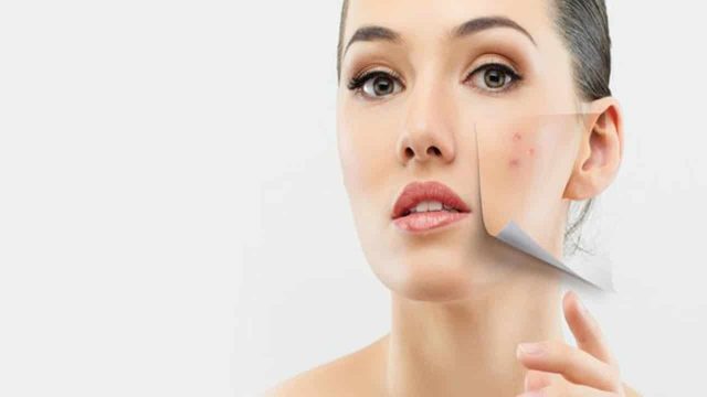 قولي وداعا للبقع الداكنة في الوجه مع هذه الطرق
