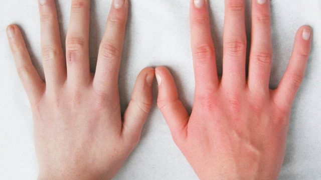 وصفات  طبيعية لتسمين اليدين