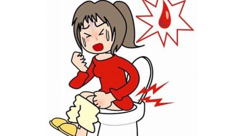 طرق فعالة لتخفيف ألم البواسير في المنزل