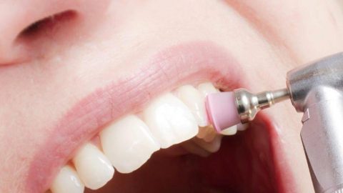 علاجات طبيعية لإزالة الجير من على الأسنان