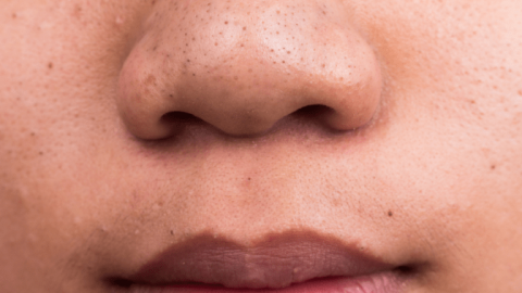 إليك طرق بسيطة للتخلص من الرؤوس السوداء بسرعة