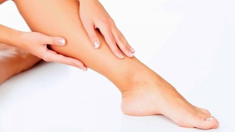 6 علاجات منزلية للقضاء على الدوالي