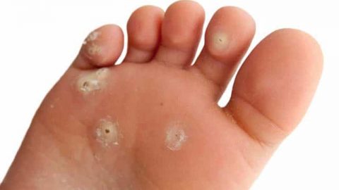 مقشر زيت جوز الهند لتنعيم القدمين