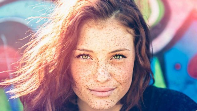 كيفية القضاء على النمش باستخدام طرق طبيعية