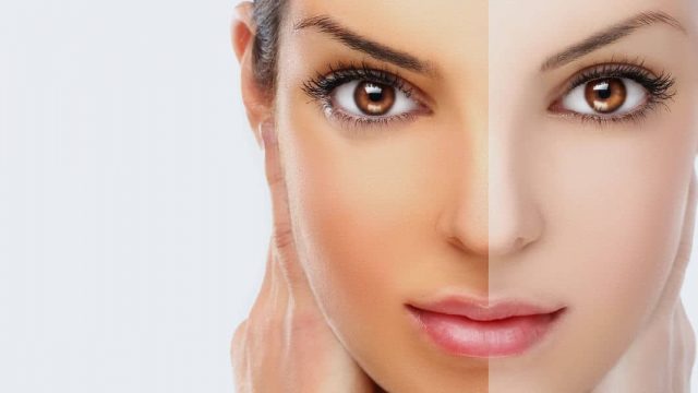 هذه المكونات ستساعدك على تفتيح بشرتك