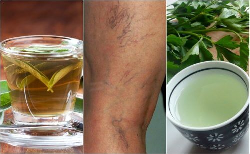 5-infusions-diurétiques-qui-vous-aideront-à-combattre-les-varices