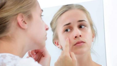 6 خطوات للتخلص من حب الشباب نهائيًا