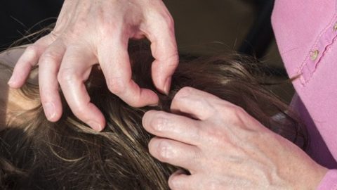 طرق التخلص من حبوب الرأس بسرعة