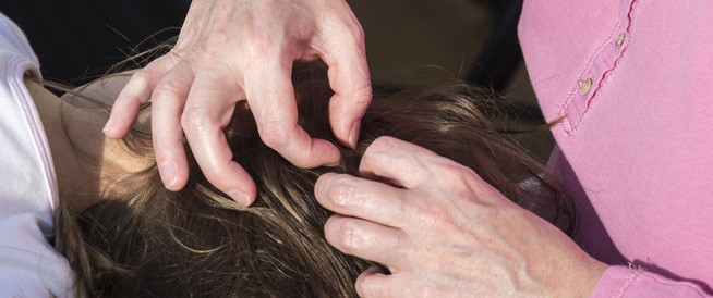 طرق التخلص من حبوب الرأس بسرعة