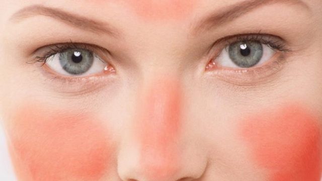 كيف تنظفين بشرتك الحساسة؟