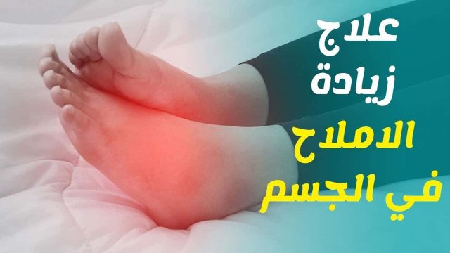 كيف يمكن التخلص من مشكلة ارتفاع الأملاح في الجسم بشكل طبيعي؟