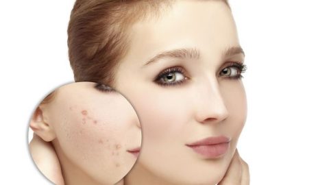 اكتشفي أقنعة القرفة الطبيعية للعناية بالبشرة