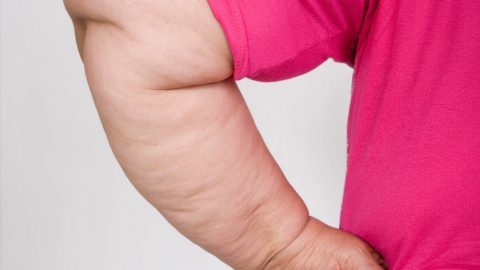 وصفات طبيعية لشد ترهلات الذراعين