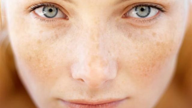 هذه المكونات المنزلية تقضي على البقع الصعبة في الوجه