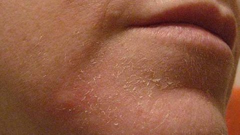 عالجي جفاف البشرة بهذه الوصفات المنزلية