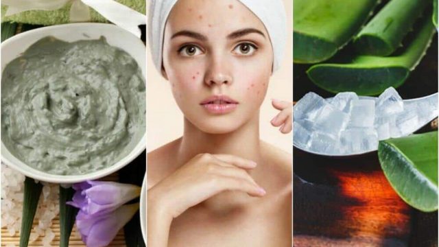 علاجات طبيعية للتخلص من البثور