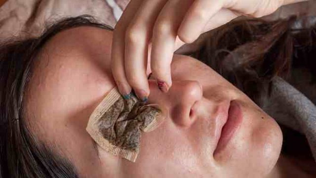 اكتشفي الاستخدامات الجمالية للشاي الأسود