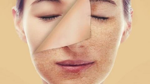 مكونات طبيعية لتغذية البشرة الجافة…جربيها  وتألقي في السنة الجديدة