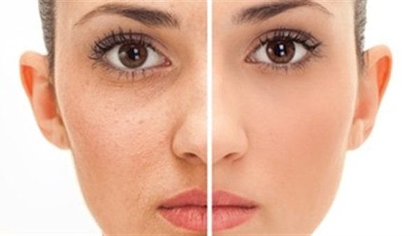 هذه الأقنعة للتخلص من جميع مشاكل البشرة