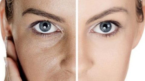 مكونات بسيطة لمعالجة المسام الواسعة