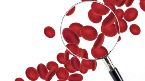 مشروبات طبيعية لعلاج فقر الدم