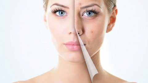 أقنعة بسيطة تخلصك من آثار الحبوب