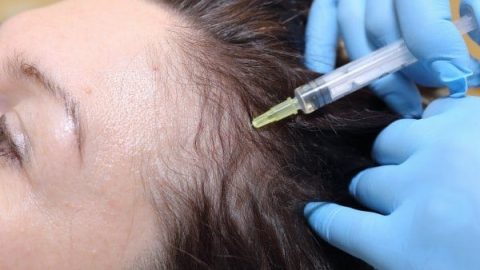 اكتشفي فوائد البتوكس والفيلر للشعر