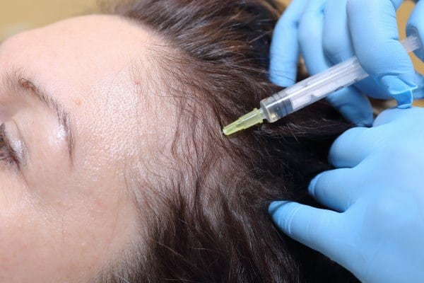 اكتشفي فوائد البتوكس والفيلر للشعر