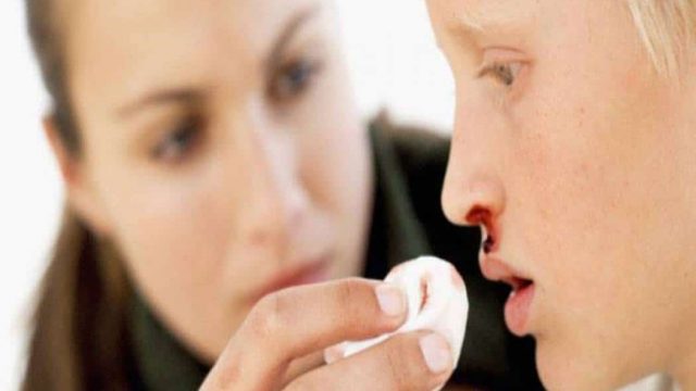 كيف تتعاملين مع الرعاف عند الأطفال؟