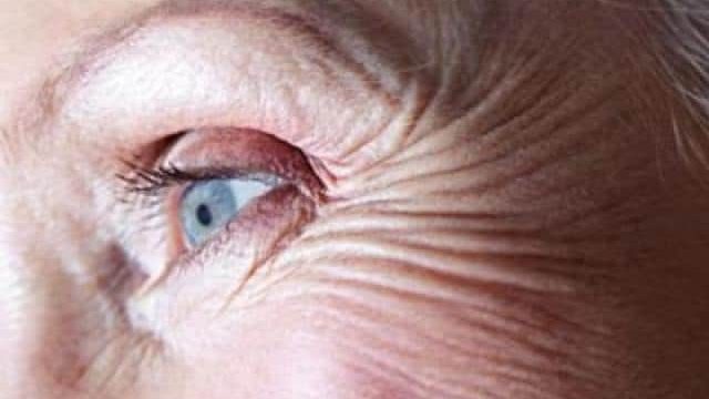 كريمات مكافحة التجاعيد ما بين الصواب والخطأ