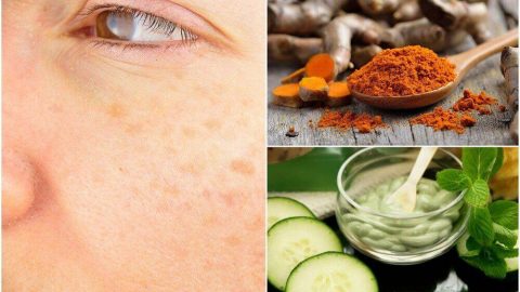 خيارات طبيعية للتخلص من البقع الداكنة مع التقدم في السن