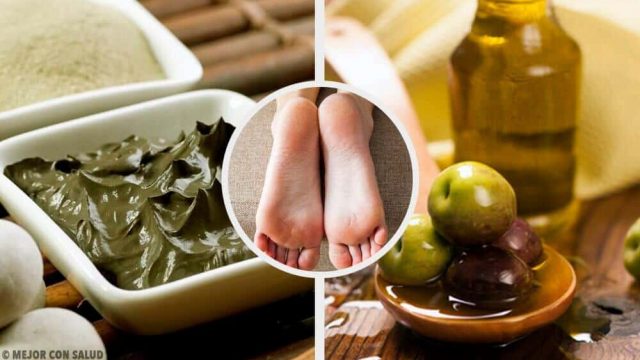 علاجات منزلية للتخلص من تشقق القدمين