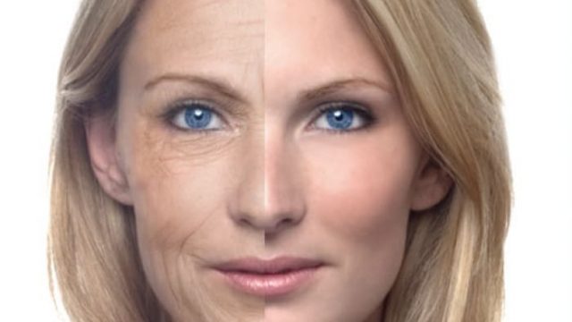 اكتشفي طريقة علاج تجاعيد البشرة باستخدام بذور الشيا