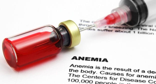 مؤشرات تدل على نقص الحديد في جسمك.. اكتشفيها