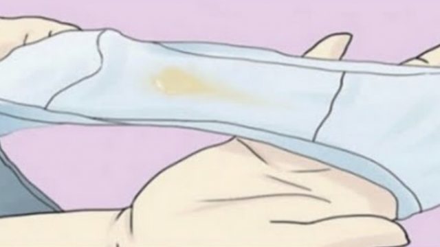 تعرفي الإفرازات المهبلية الطبيعية والغير طبيعة