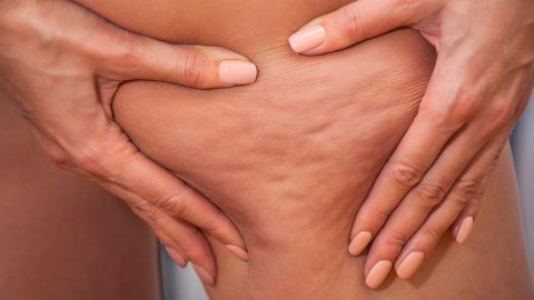 مقشرات طبيعية لعلاج السيلوليت.. جربيها