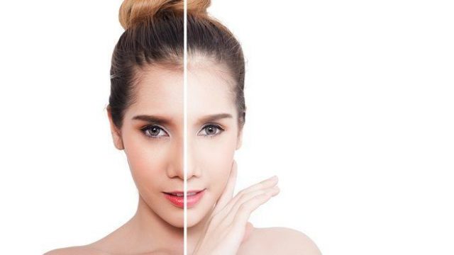 تعرفي على أفضل الخلطات الطبيعية لتفتيح البشرة الدهنية