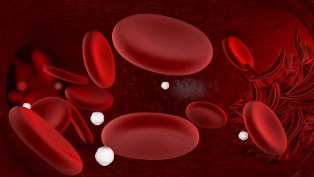 علاجات فعالة للتخلص من فقر الدم بطريقة طبيعية