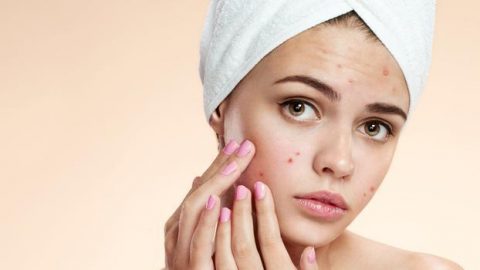 3 خطوات للتخلص من حب الشباب بسرعة