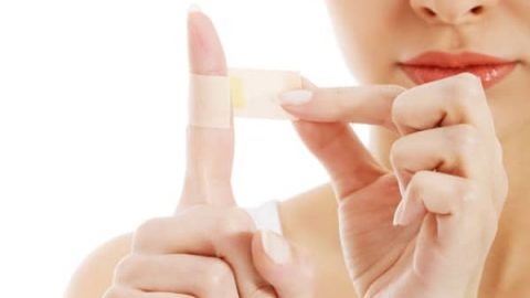 العسل أفضل علاج طبيعي لآثار الحروق