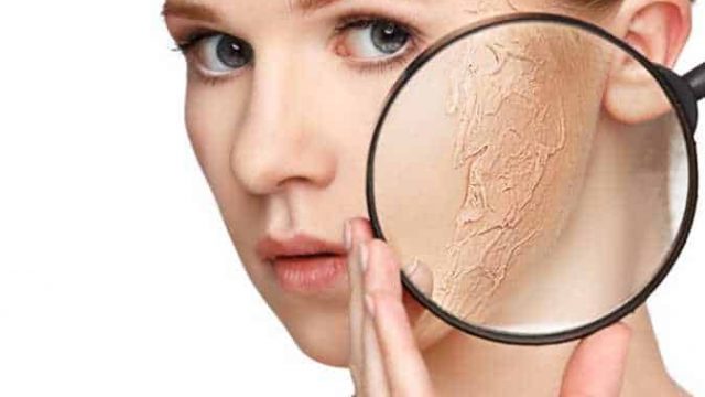 دليلك للاهتمام بالبشرة الجافة هذا الصيف