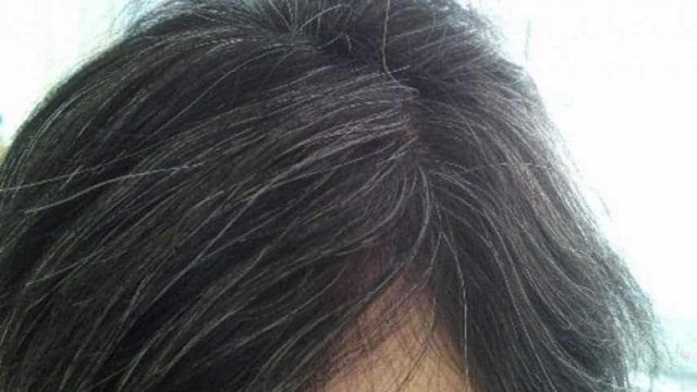 تخلصي من الشعر الأبيض بهذه الخلطات