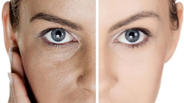 طرق طبيعية للتقليص من حجم مسام البشرة