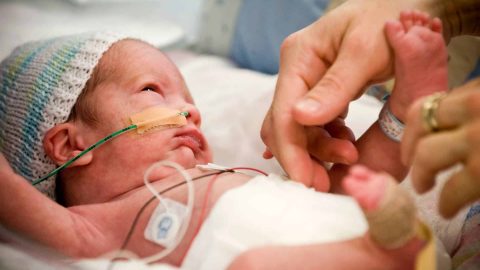 تعرفي على أسباب الولادة المبكرة وكيفية التعامل معها