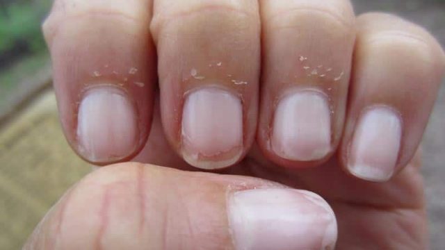 تخلصي من جفاف الأظافر بهذه الخلطات الطبيعية البسيطة