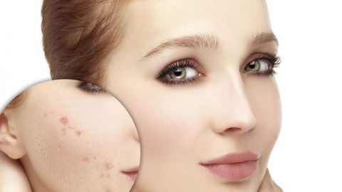 أفضل قناع للبشرة الدهنية لا تفوتي تجربته