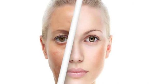 تقنية تقشير الوجه بين الفوائد والأضرار