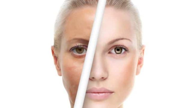 تقنية تقشير الوجه بين الفوائد والأضرار